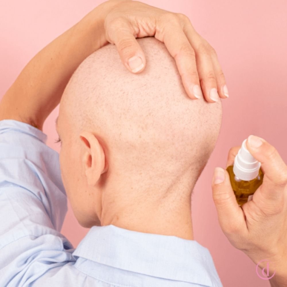 Même Loción calmante hidratante cuero cabelludo quimioterapia