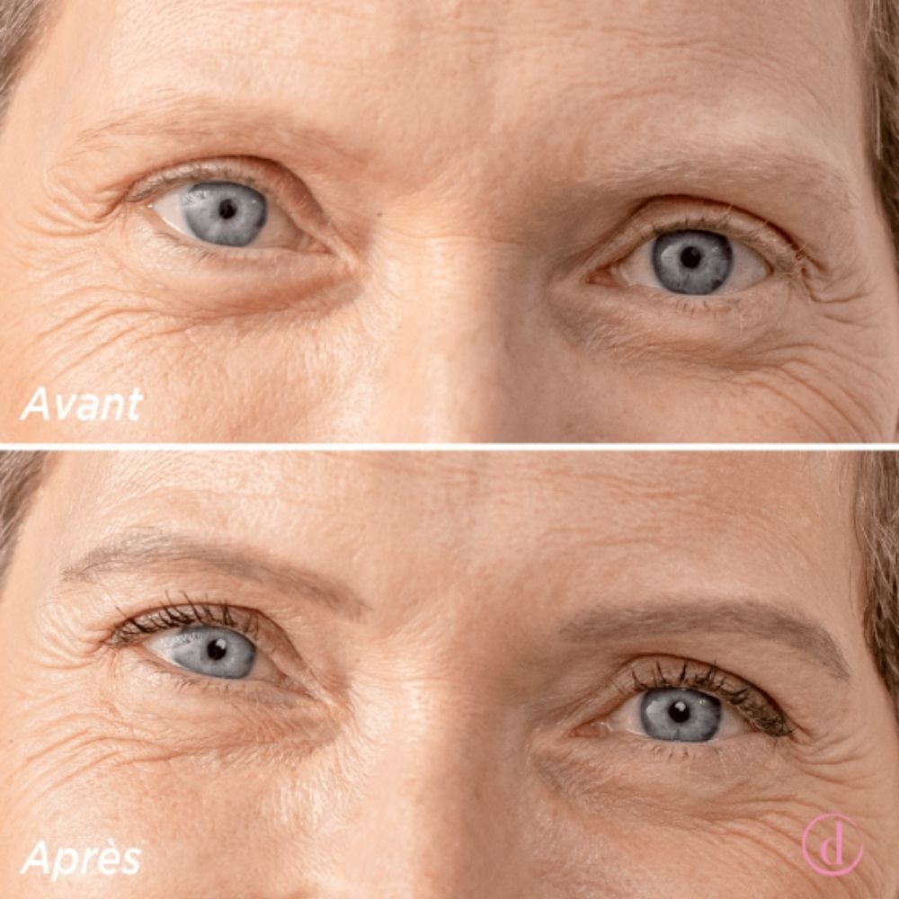Même Delineador de Cejas Quimioterapia