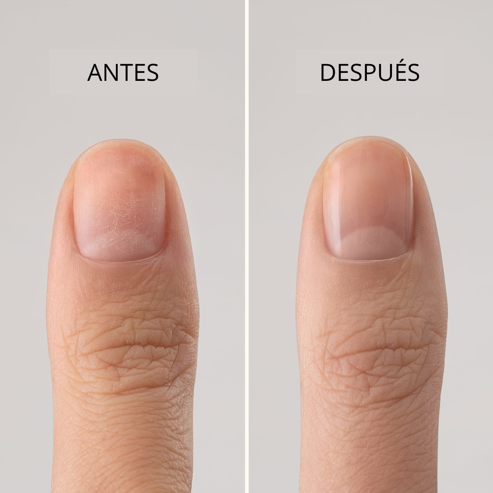 MÊME Esmalte base silicio y antioxidantes protector uñas quimioterapia