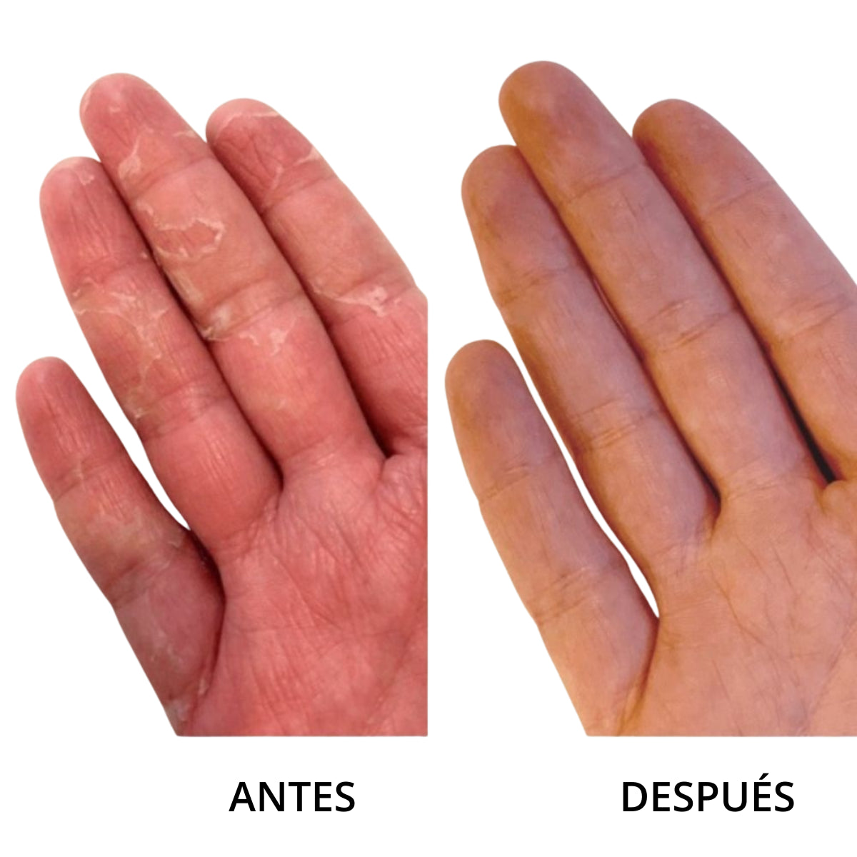 Guantes de Hidratación Intensiva para Tratamiento de Manos – MÊME