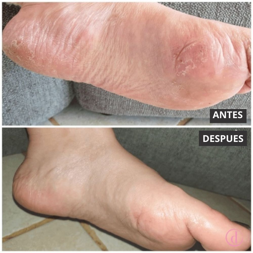 Calcetines de Hidratación Intensiva para Tratamiento de Pies – MÊME